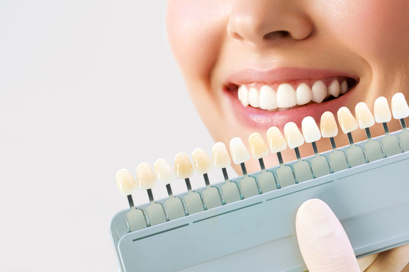 a patient getting color matched veneers to fix their gummy smile
