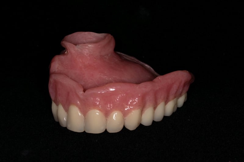 palatal obturators prosthodontist Washington DC